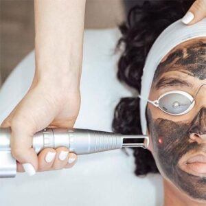 Hollywood Carbon Facial Bulleen