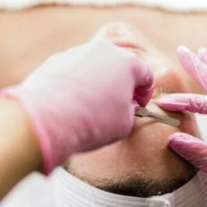 Dermaplaning Bulleen